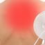 What are the side-effects of radio therapy?