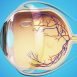 What are the symptoms of detached retina?