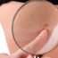 What are the symptoms of skin cancer?