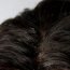 What causes dandruff?