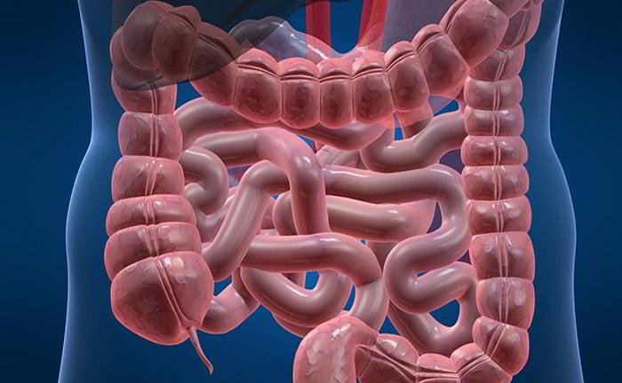 What do you mean by colitis?