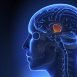 What does stroke affect the most?