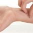 What is allergic dermatitis?