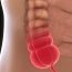 What is appendix?
