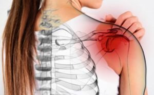 What is meant by 'frozen' shoulder?