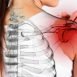 What is meant by 'frozen' shoulder?