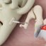 What is otosclerosis?