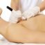 What is 'partial' mastectomy?