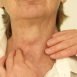 Where can we find thyroid gland?