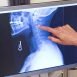 Why barium meal essential to get the stomach examined by the doctor?