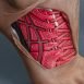 Why does intermittent claudication take place?