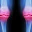 Why does Osteoarthritis take place?