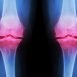 Why does Osteoarthritis take place?