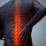 Why does osteoporosis. take place?